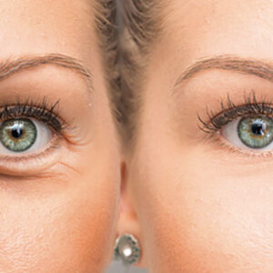 Tratamiento Rejuvenecedor para Ojos y Labios